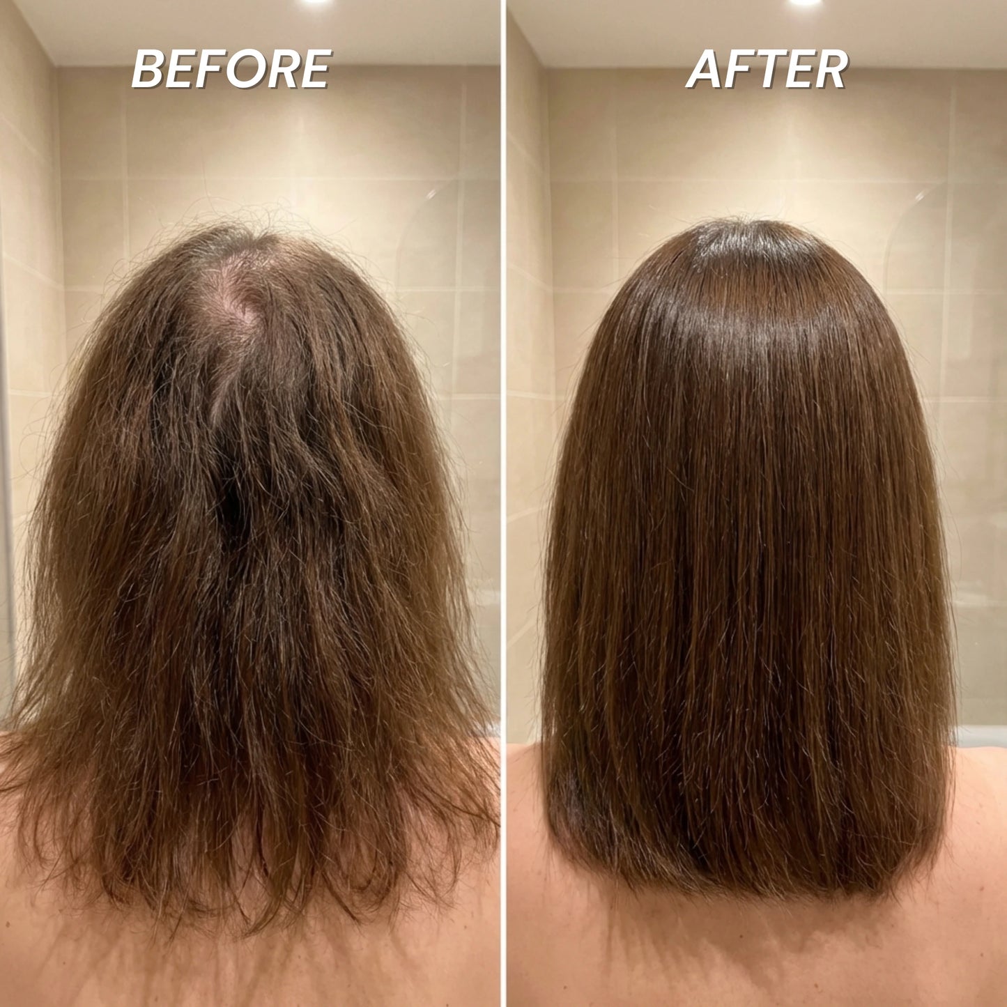 Rinselab Filtered Shower Head™