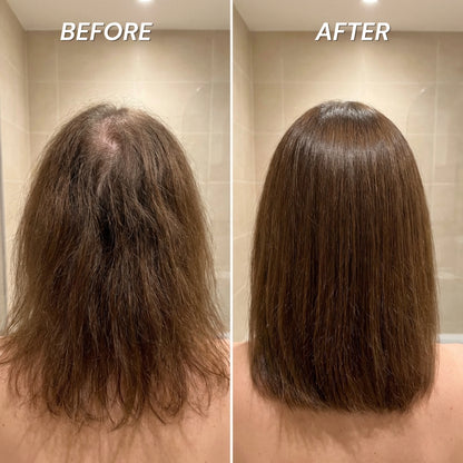 Rinselab Filtered Shower Head™