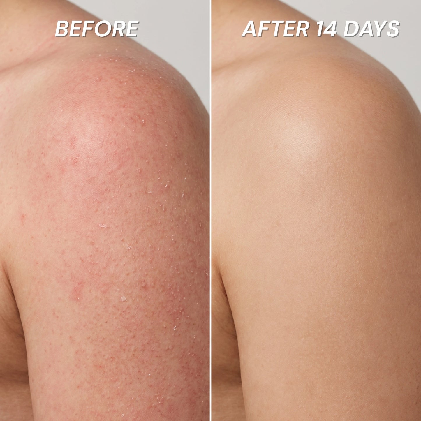 Rinselab Filtered Shower Head™